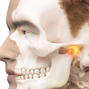 Kiefergelenktherapie