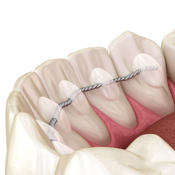 Langzeitstabilisierung